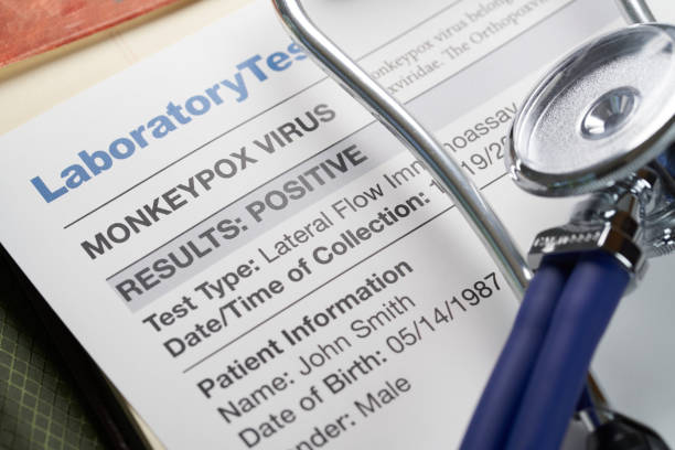 Using a Stethoscope to Detect Subarachnoid Hemorrhage